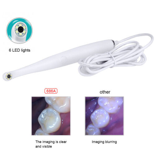 1280*720 USB Observation Camera 1/4″ CMOS Oral Camera with 6PC White LED CF-686A