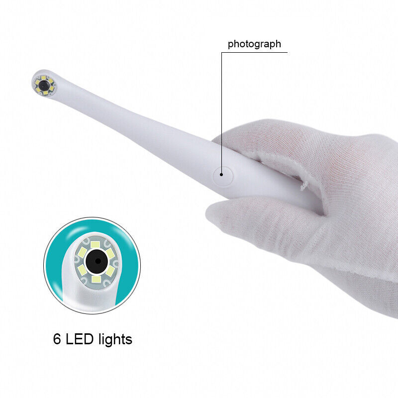 1280*720 USB Observation Camera 1/4″ CMOS Oral Camera with 6PC White LED CF-686A