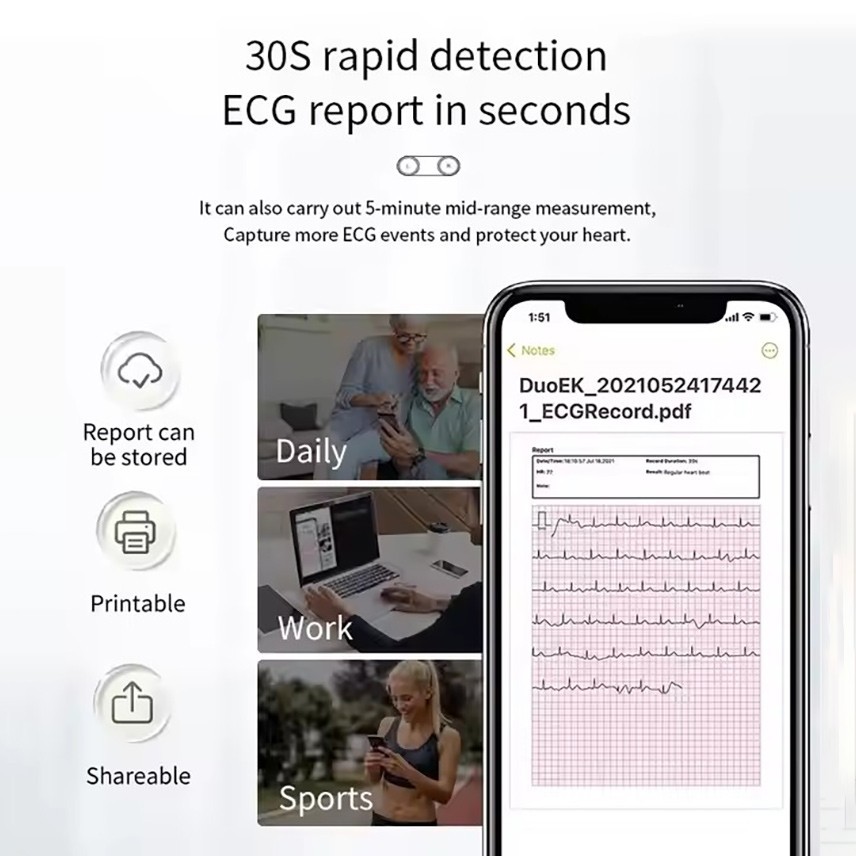 24-hour Holter monitor can generate PDF electrocardiograms and analysis reports
