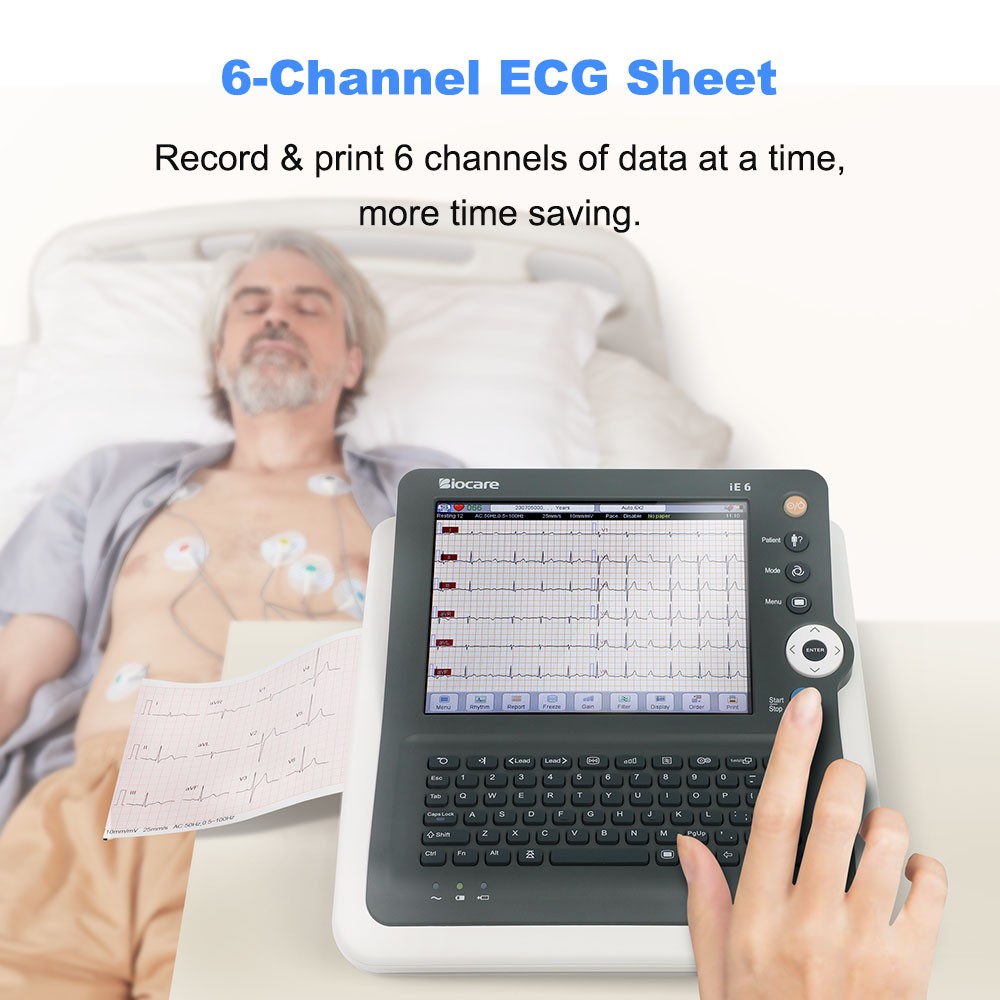 IE6 12-Lead 6-Channel ECG EKG Machine Electrocardiograph with Interpretations US
