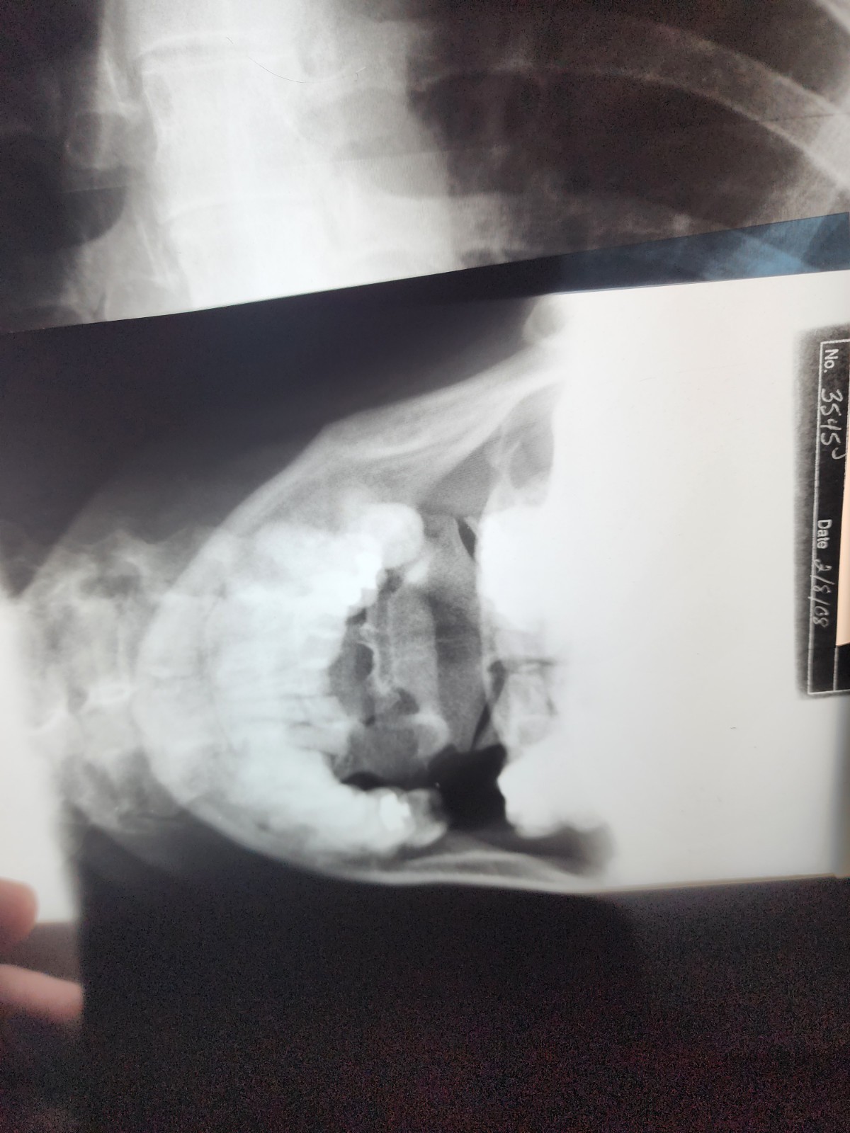 SCRAP X-RAY FILM – 1LB Silver Recovery Educational, Halloween