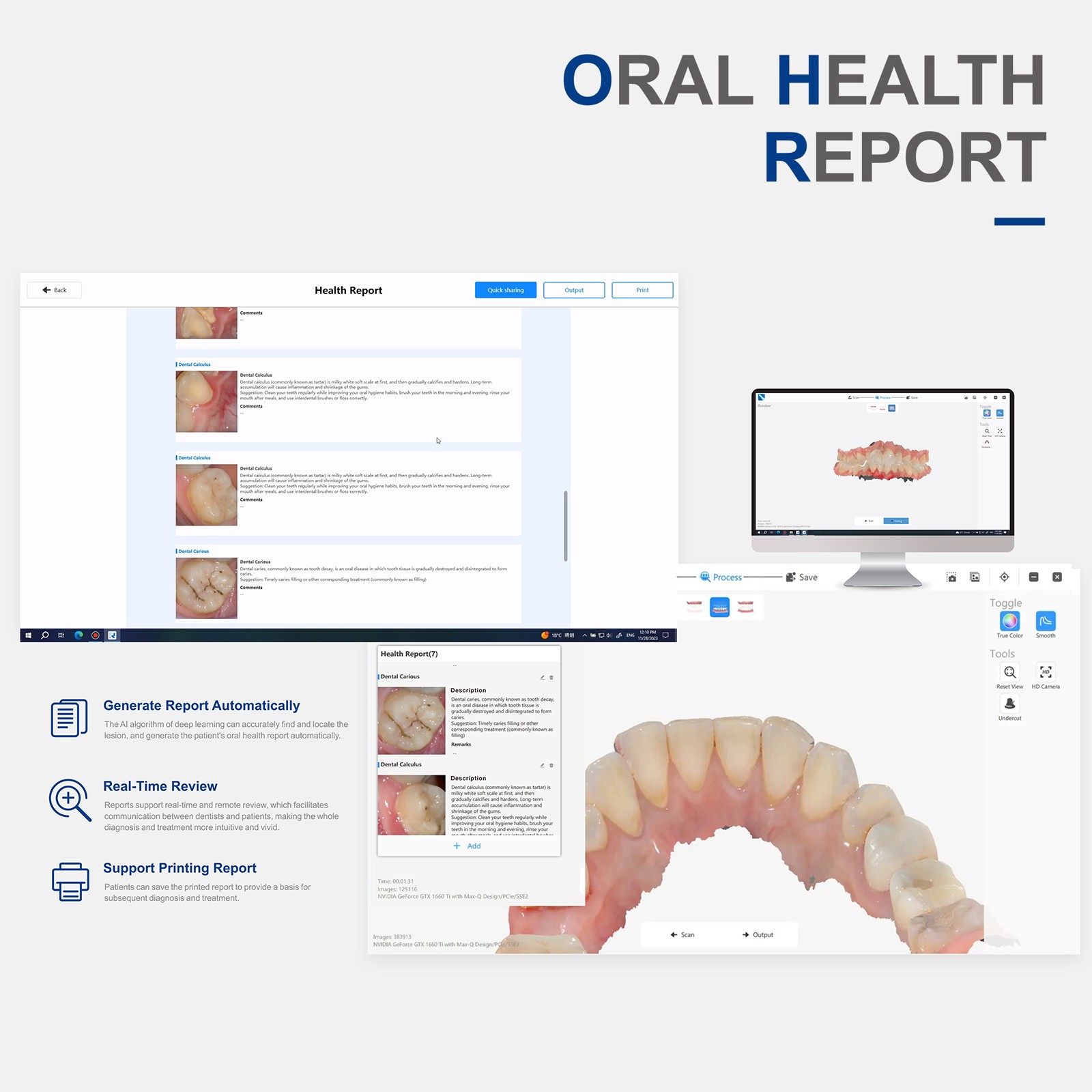 2025 Dental Intra-oral 3D Scanner – Aorascan 3 with Scanning Software