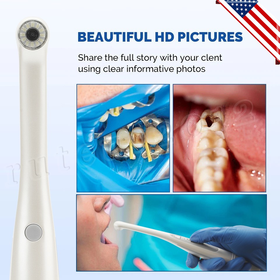 (USB 2.0) Dental Intraoral Camera Imaging Unit