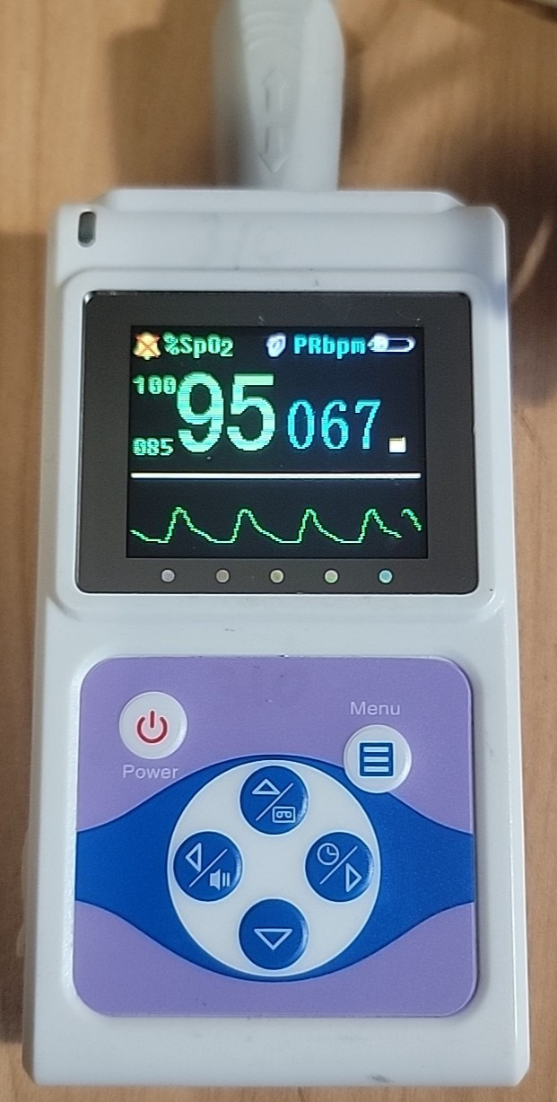 FaceLake CMS60D Handheld Pulse Oximeter Blood Oxygen PR Monitor – TESTED READ