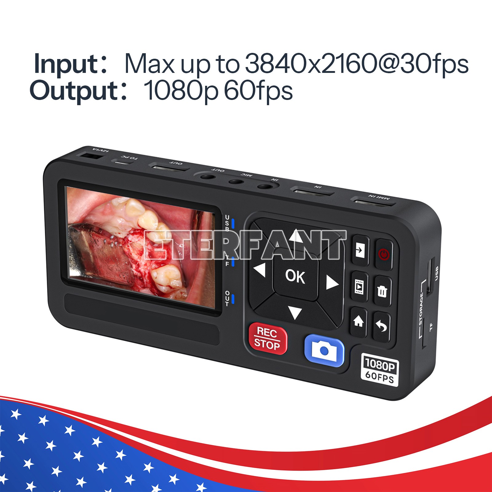 Medical Surgical Recorder HD50 HD60/Surgery Inspection Laparoscopic Camera ENT