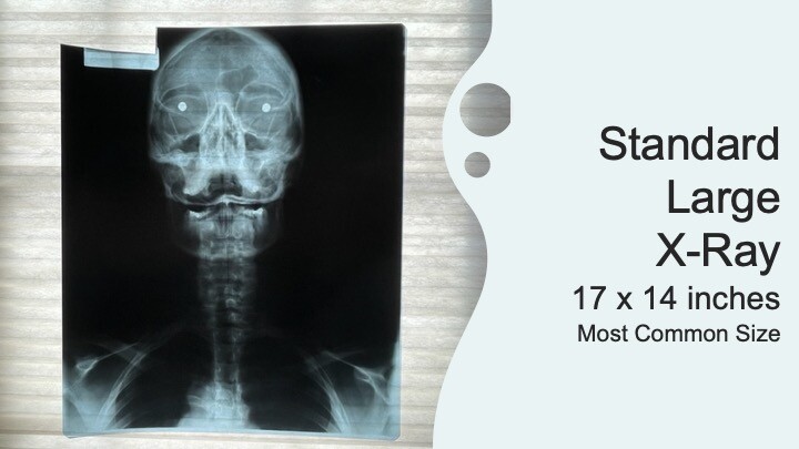 SCRAP X-RAY FILM – 1 LB, 3 LB, 5 LB, 10 LB (Silver Recovery/Teaching) – EXPOSED