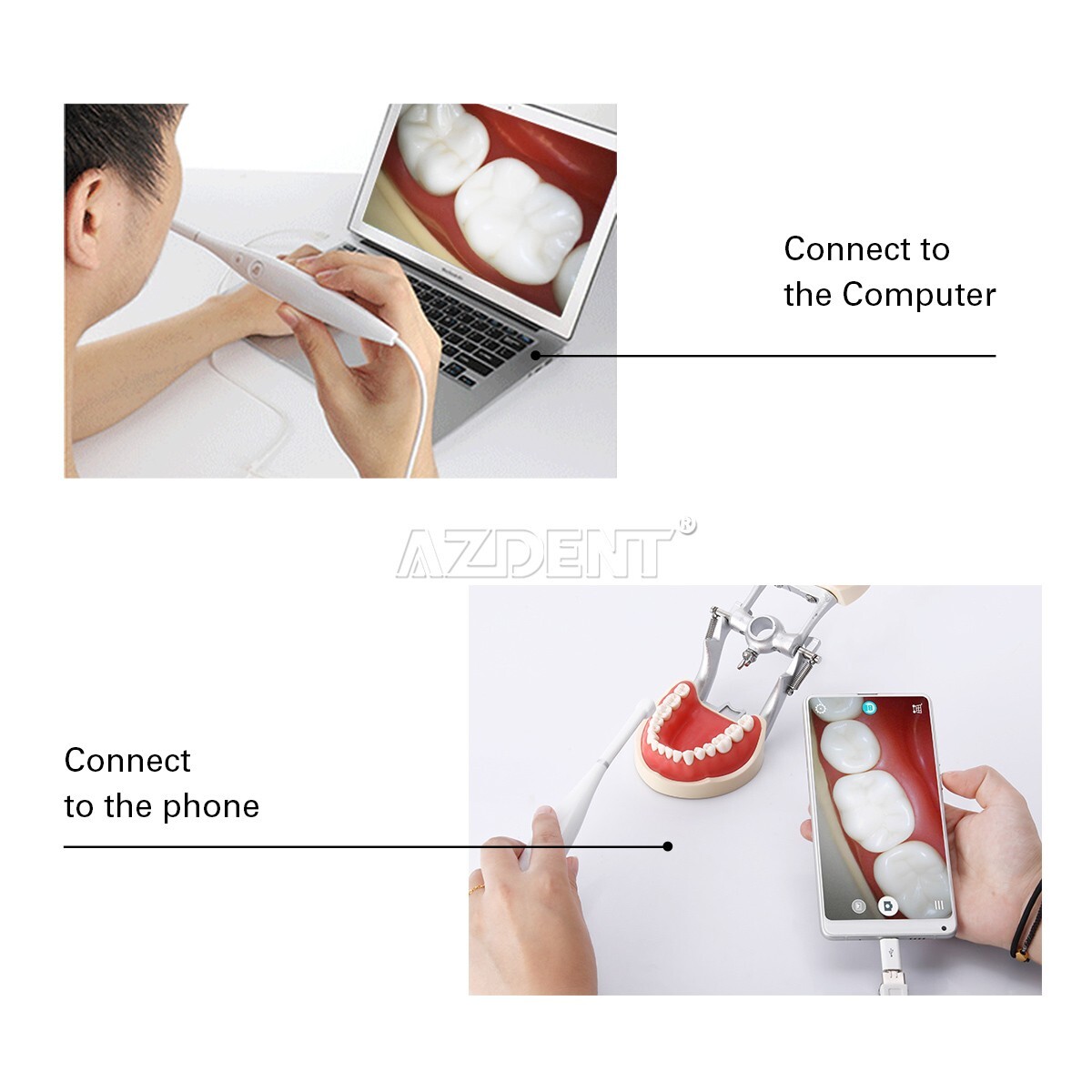 AZDENT Dental HD Intraoral Camera USB Digital Imaging Endoscope 8 LED Light