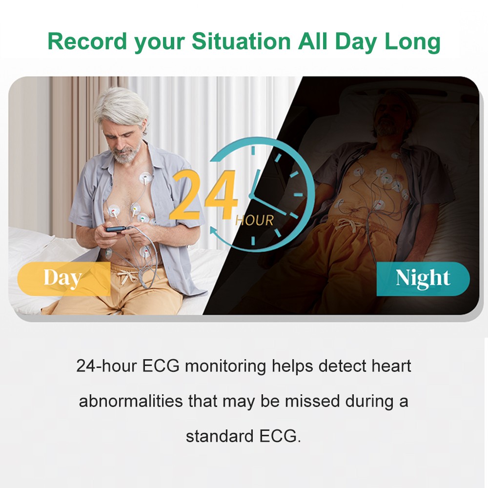 AI Analysis EKG Monitor Heart Monitor 30s/60s/5min Recording with App PC Report