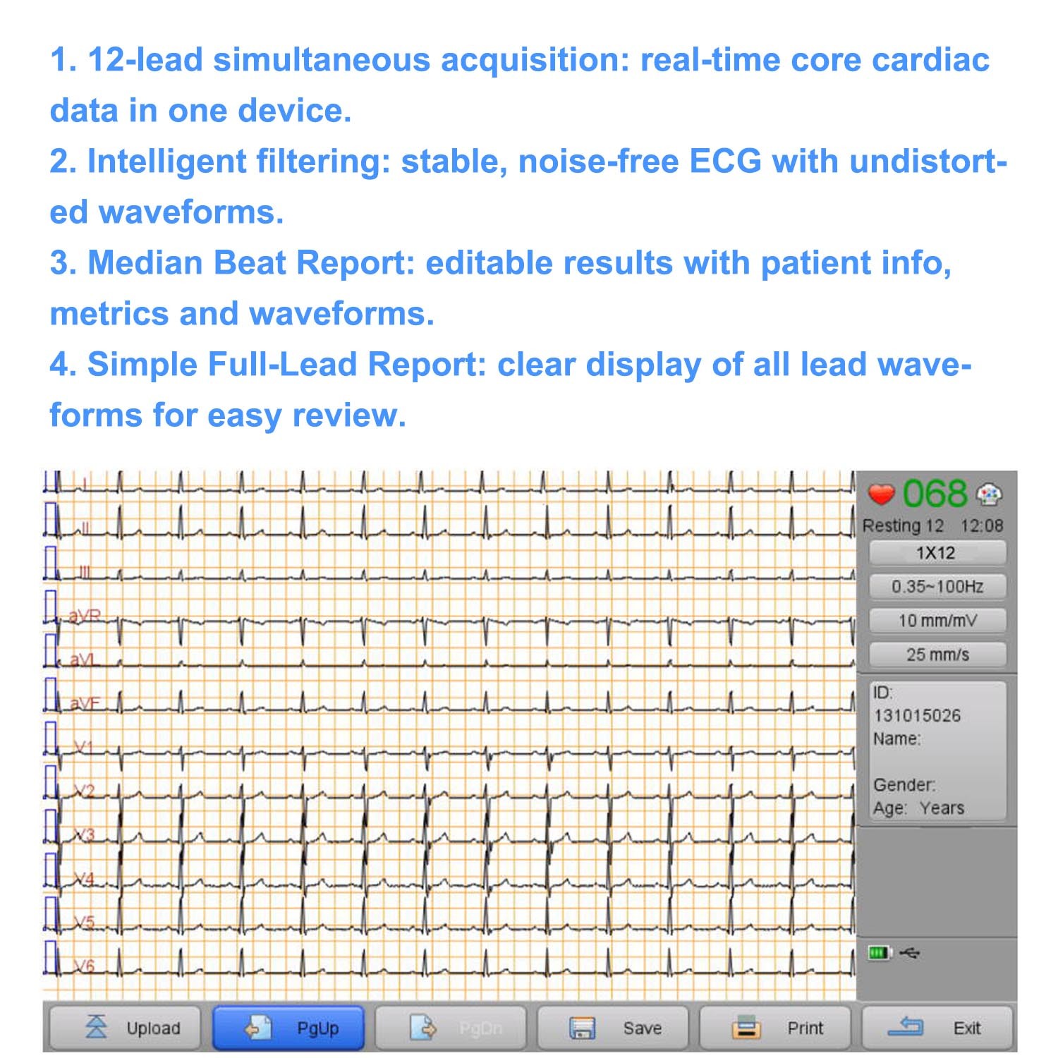 12 Lead ECG/EKG Machine w Interpretation Electrocardiograph Auto-analysed Result
