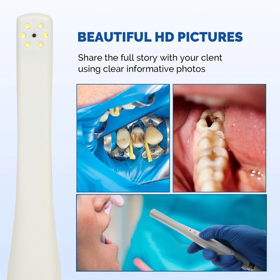 Dental Oral Camera USB Imaging HD Camera 6 LED light / 100*Sleeve Sheath