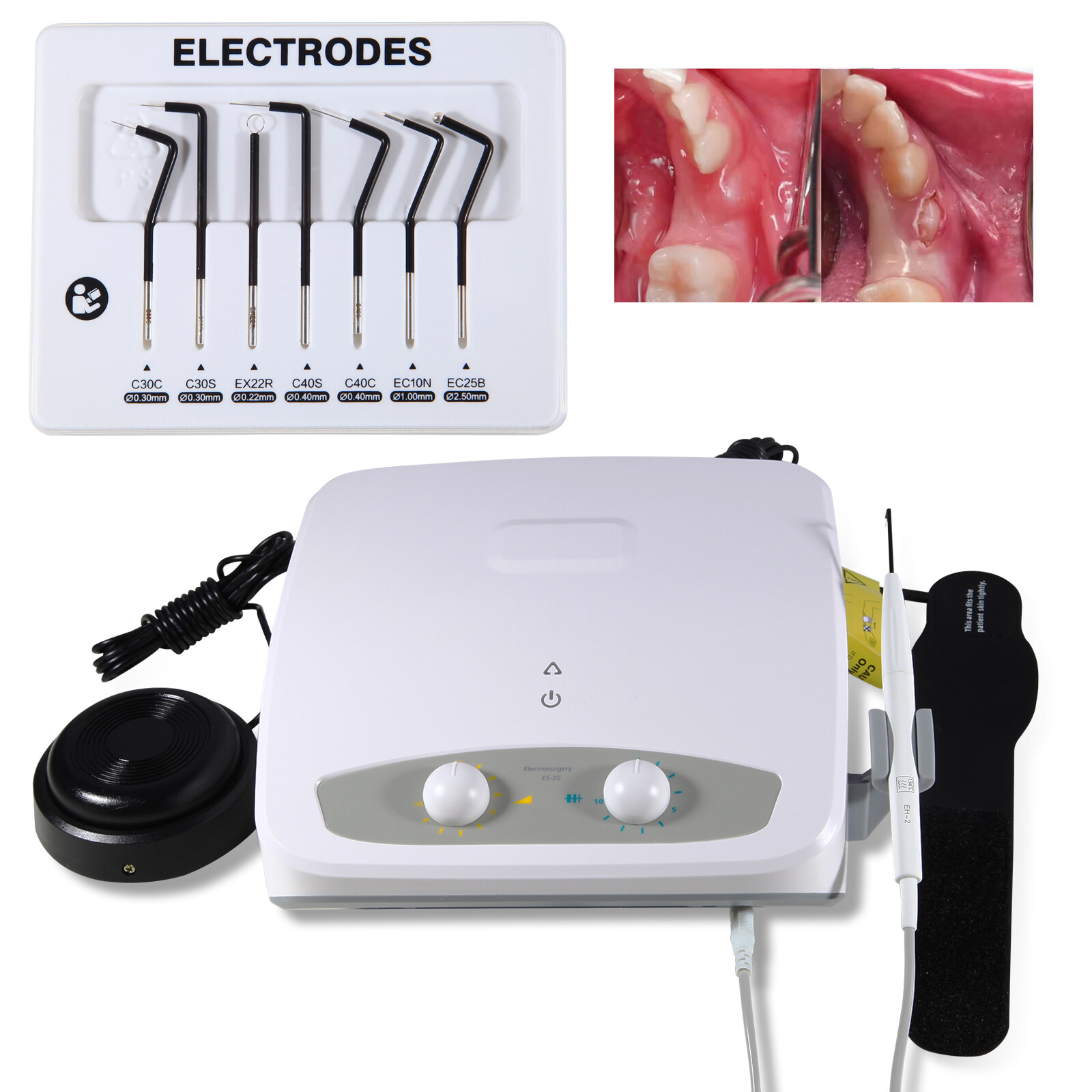 Dental Electro Electrosurgery Unit Machine High Frequency Electric w/7 Electrode