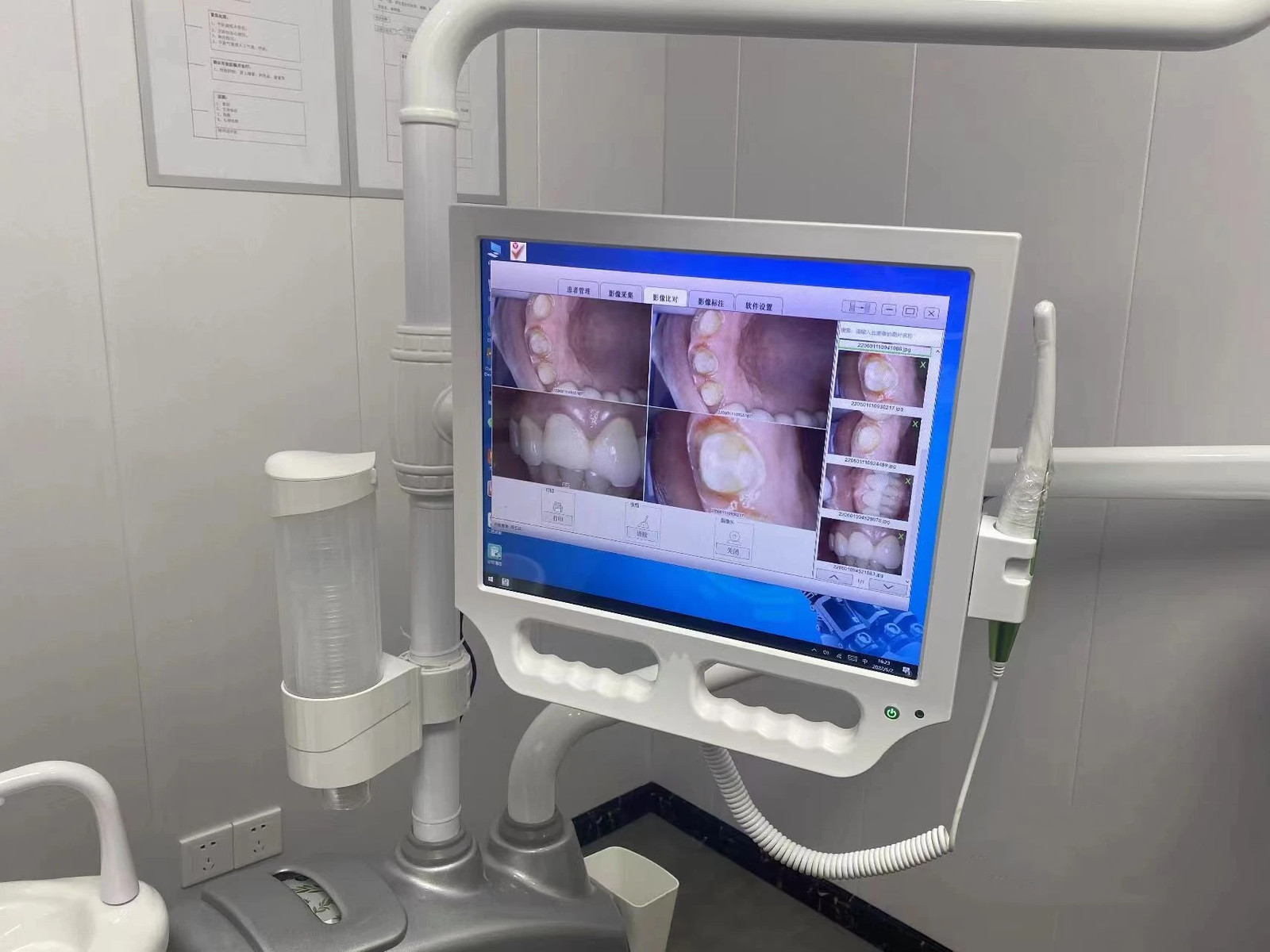 Dental Intra Oral Camera 17 Inch Screen 12 MP HD Endoscope Camera 6 LED Light