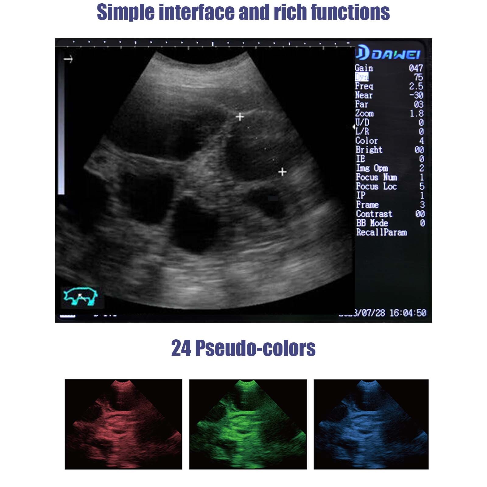 Veterinary Ultrasound machine Vet ultrasound Scanner 7.5Rectal Probe For animals
