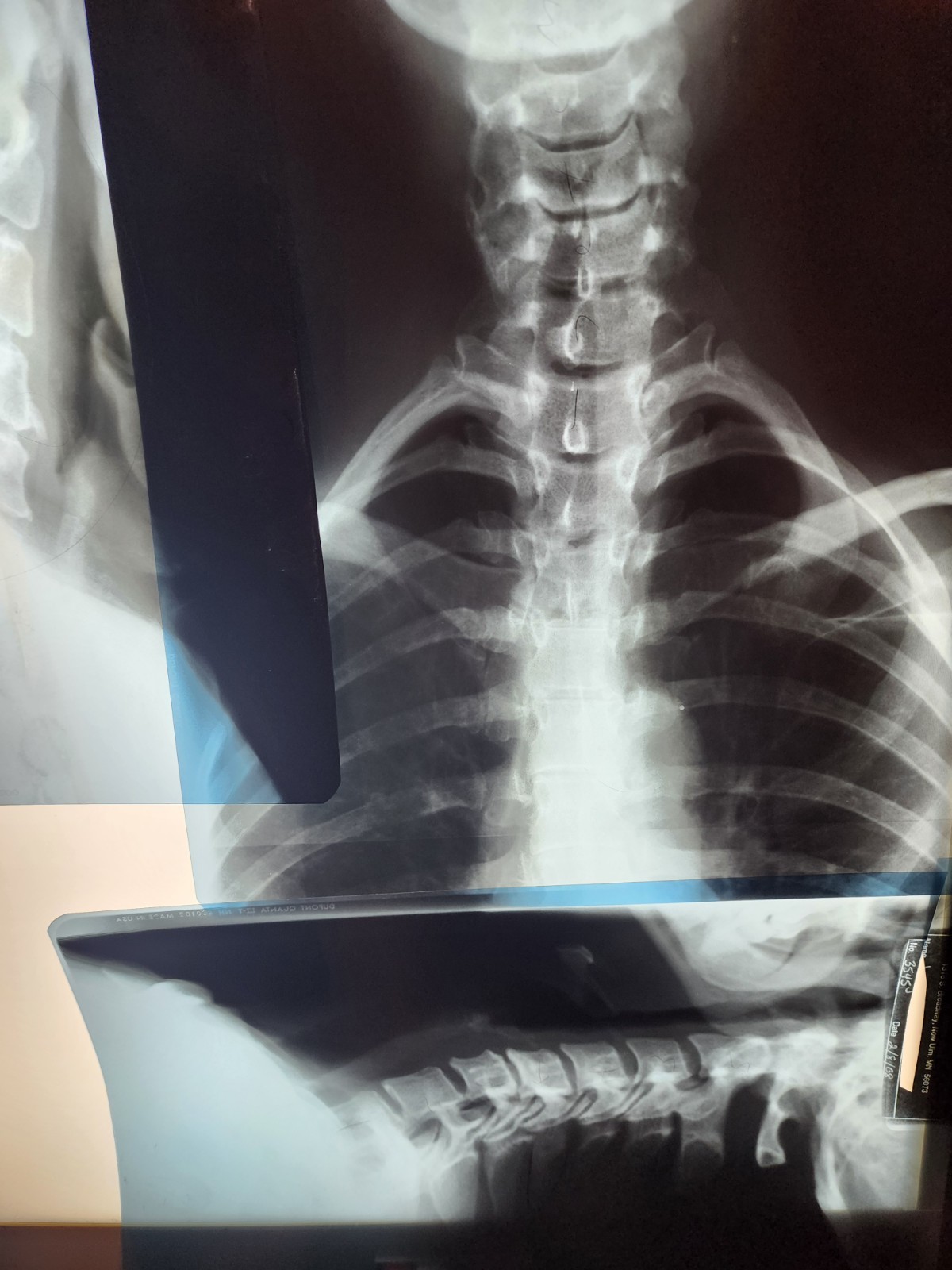 SCRAP X-RAY FILM – 1LB Silver Recovery Educational, Halloween