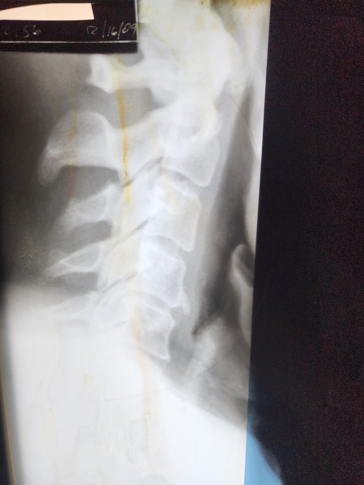SCRAP X-RAY FILM – 1LB Silver Recovery Educational, Halloween
