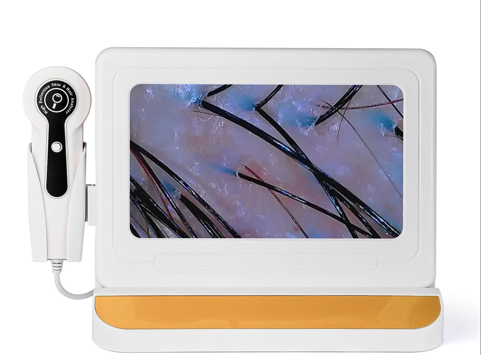 11 Inch Scalp Microscope Camera 50x 200x Follicle Analysis