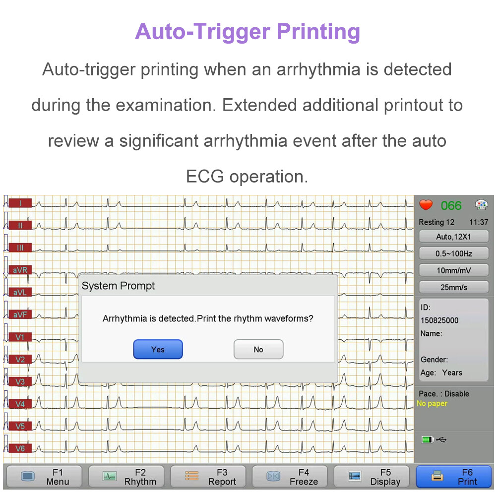 12 lead ECG Machine with Interpretation VCG Acquisition and 12 channel ECG Paper