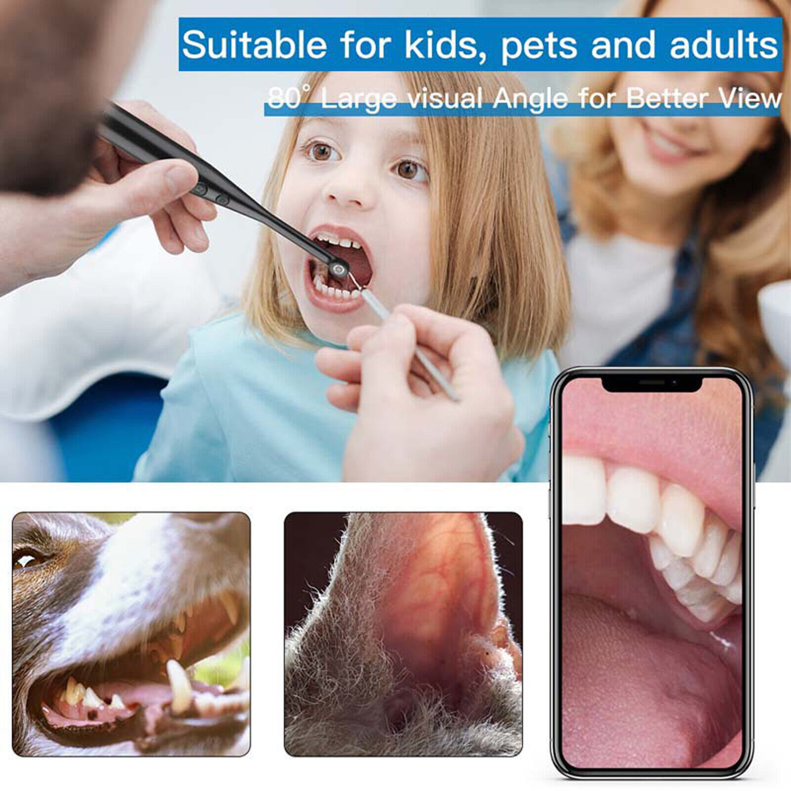 3 in 1 6 LED Light Oral Dental Intraoral Camera Endoscope For Phone/PC HD 720P