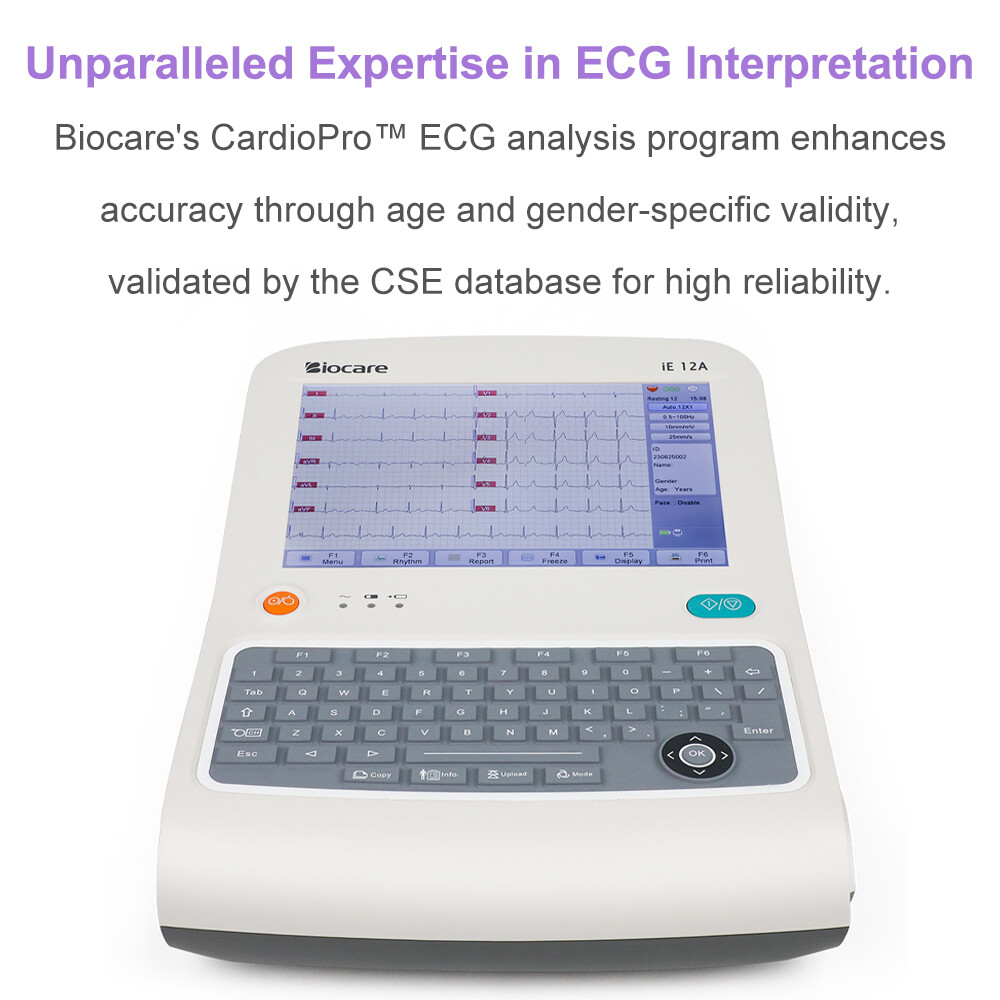 12 lead ECG Machine with Interpretation VCG Acquisition and 12 channel ECG Paper