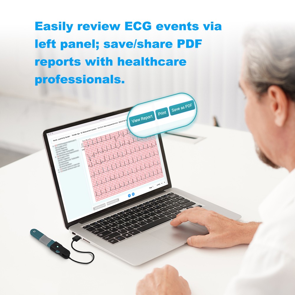 24 hours ECG/EKG Holter Monitor System with AI analysis Detects Afib PC Software