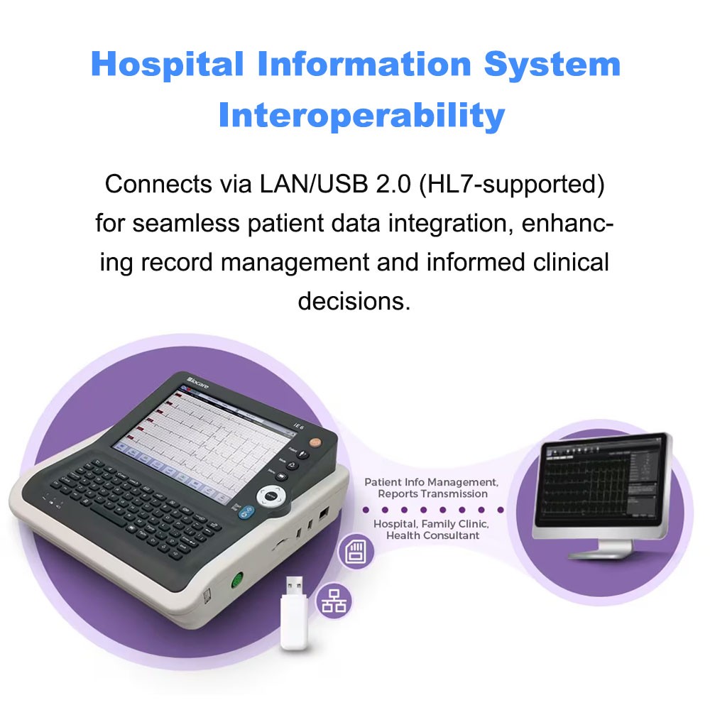 IE6 12-Lead 6-Channel ECG EKG Machine Electrocardiograph with Interpretations US