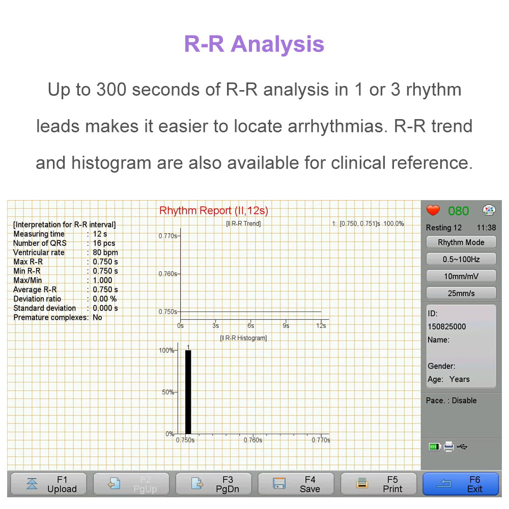 12 lead ECG Machine with Interpretation VCG Acquisition and 12 channel ECG Paper