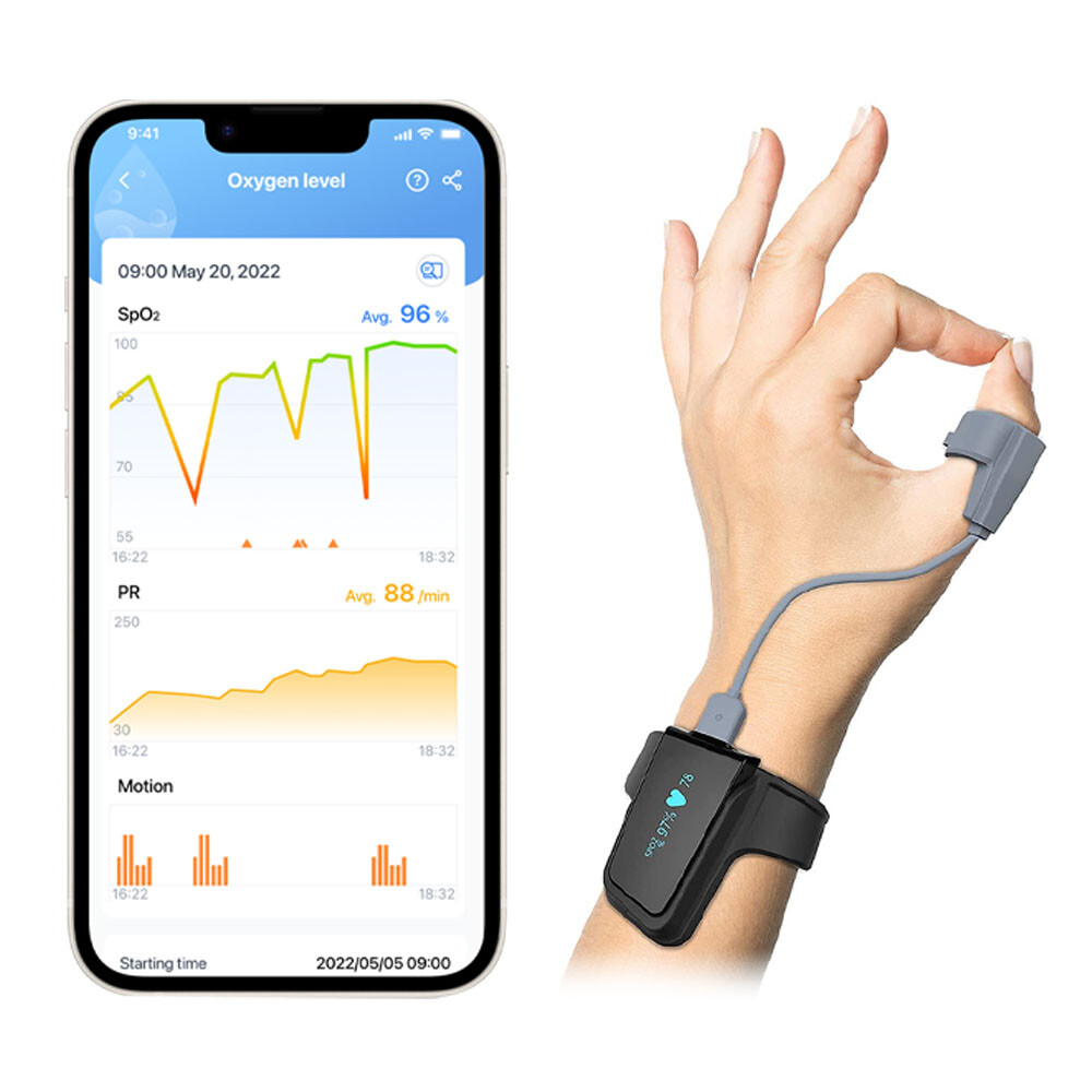 Checkme O2 Max Pulse Oximeter for SpO2 and Heart Rate Tracking Continuously