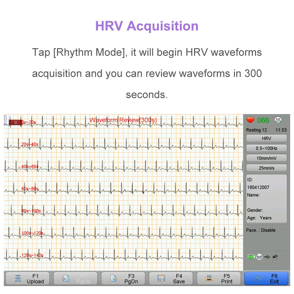 12 lead ECG Machine with Interpretation VCG Acquisition and 12 channel ECG Paper
