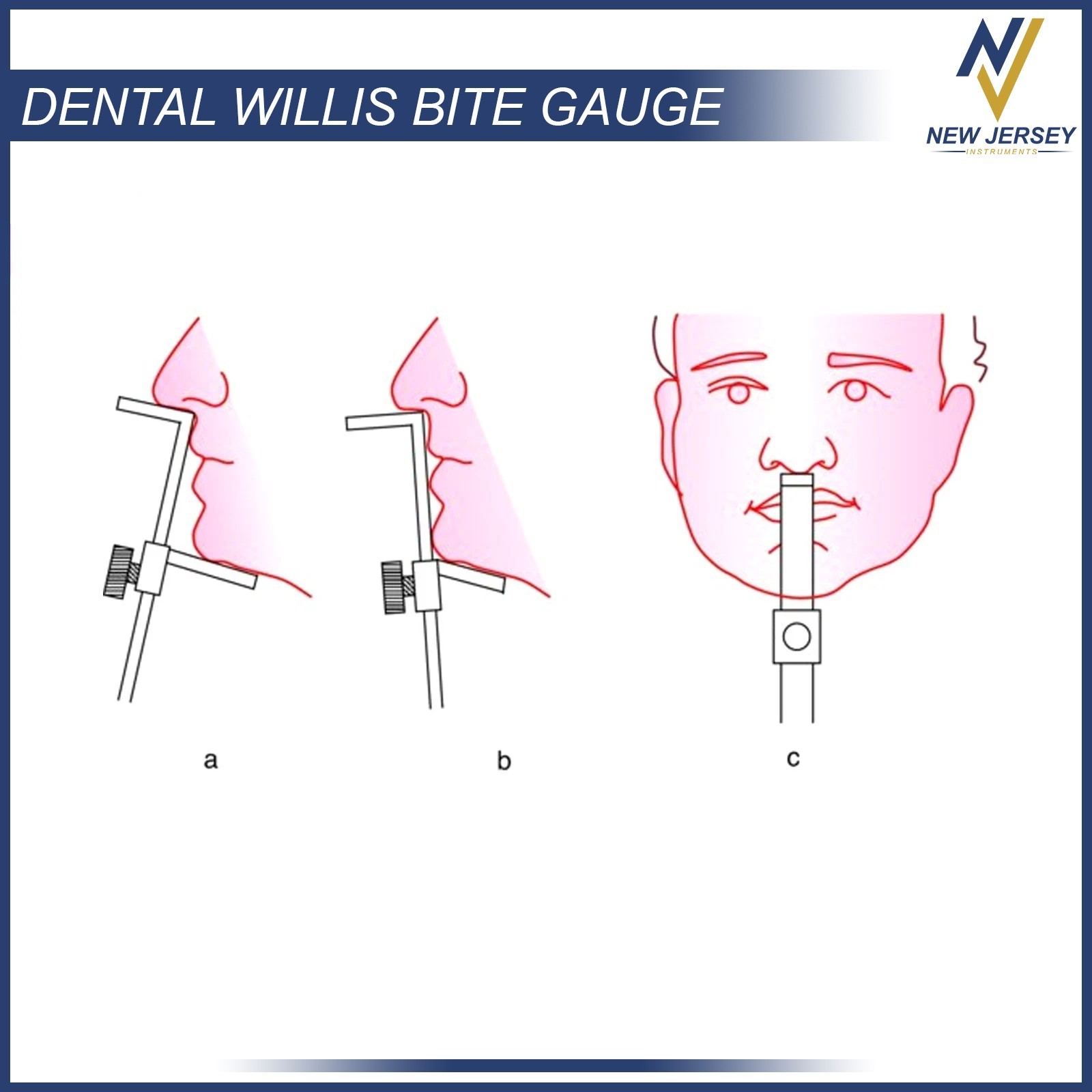 Dental Willis Bite Gauge Stainless Steel Orthodontic Dental Measurement Gauge