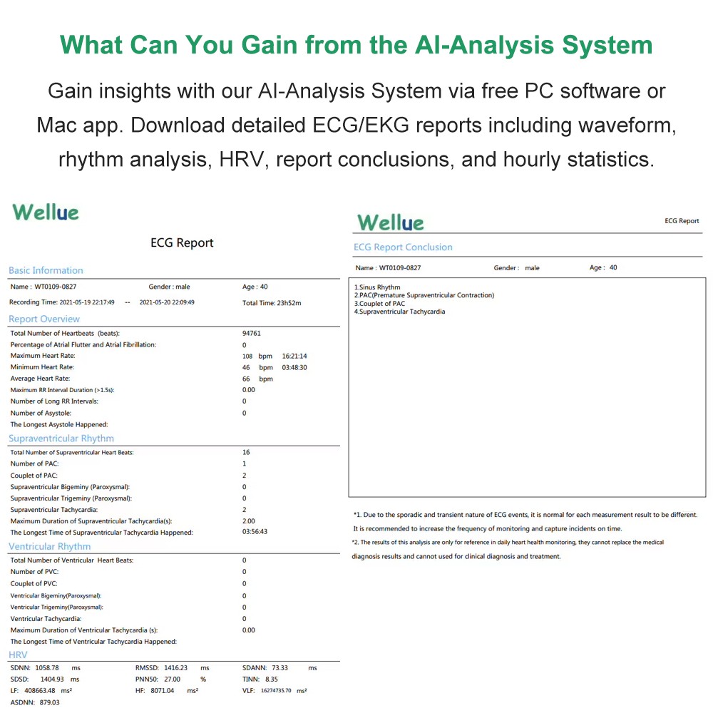AI Analysis EKG Monitor Heart Monitor 30s/60s/5min Recording with App PC Report
