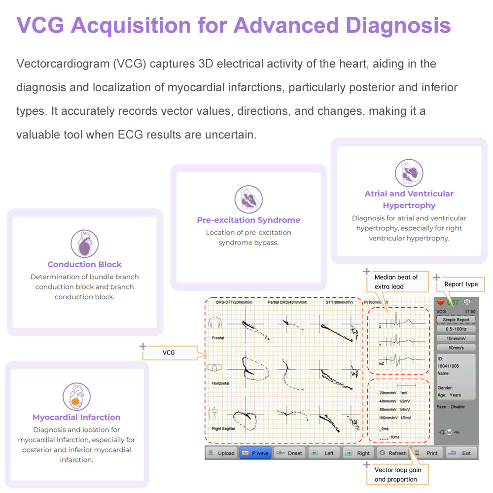 ECG Machine 12 lead/Channel with interpretation for Advisory Diagnosis Printing