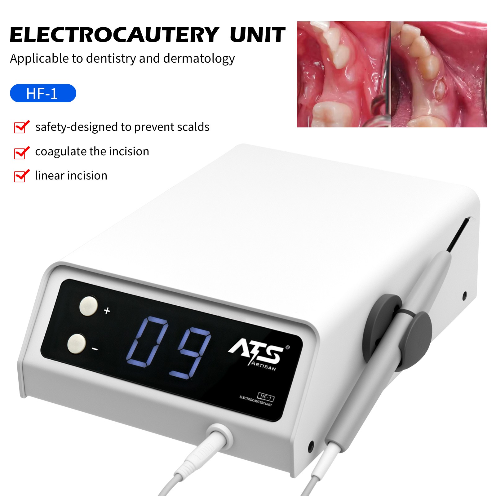 Dental Electrosurge Electrosurgery Unit for Cutting + Coagulating