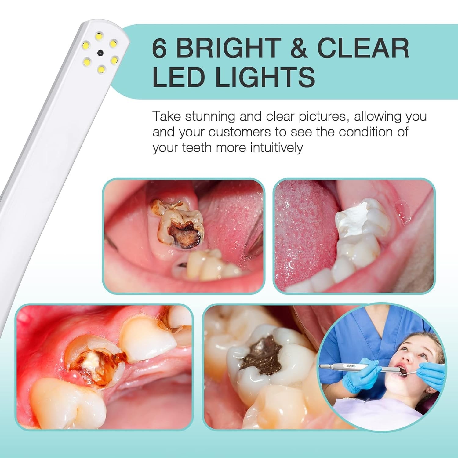 Intraoral Camera PD740, Capture Button Driver to Work with Eaglesoft, Dexis, …