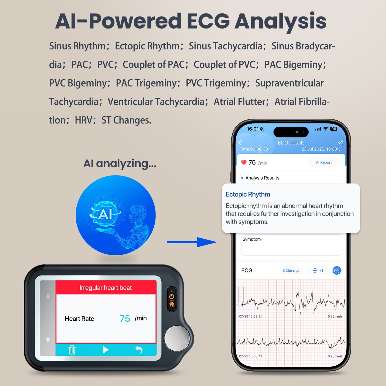 ECG EKG Monitor 30s/60s/5min Recording AI-ECG Analysis Report in App PC Software