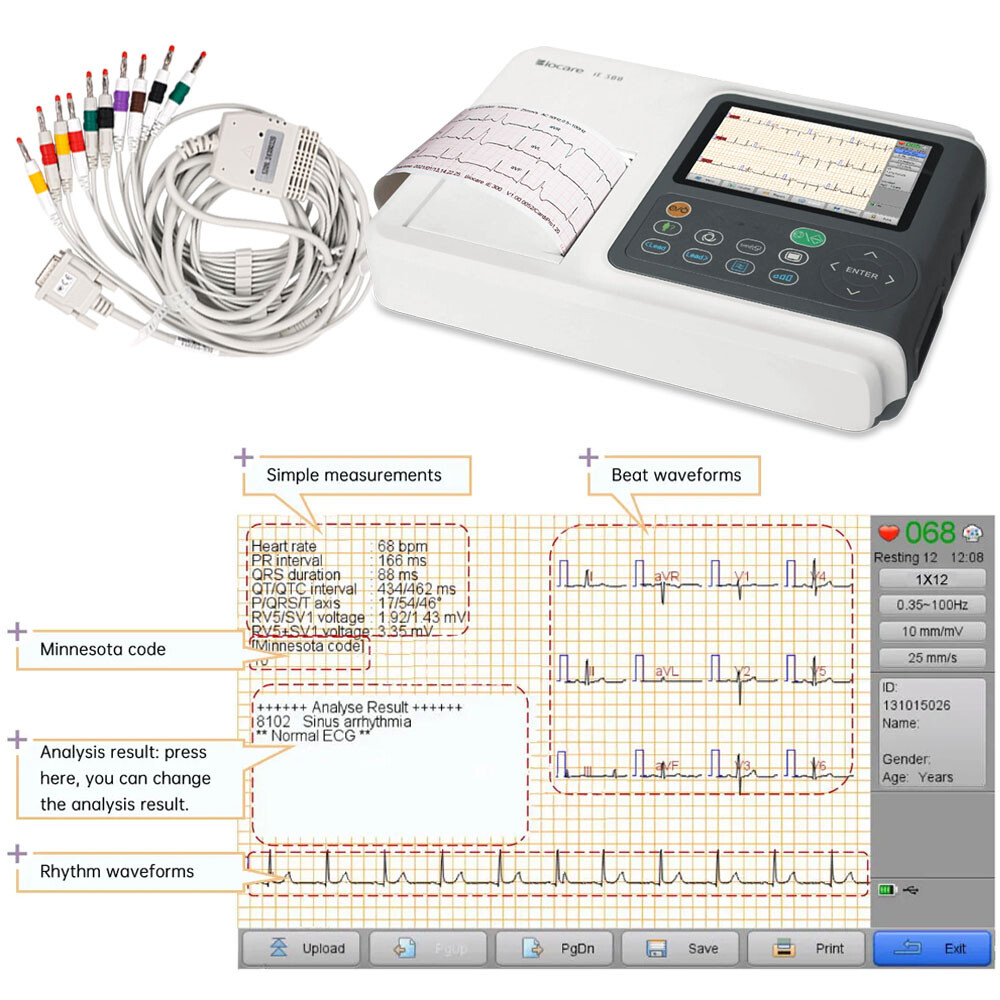 12 Lead ECG/EKG Machine w Interpretation Electrocardiograph Auto-analysed Result