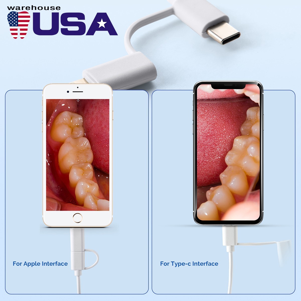 Dental Intraoral Camera High Resolution Interface 8 White Cold Light LED USB