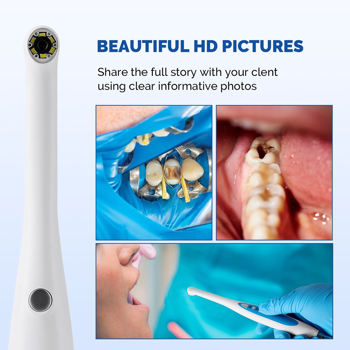 Dental Intraoral Camera 720p HD Endoscope Adjustable 6 LED Light USB Cable