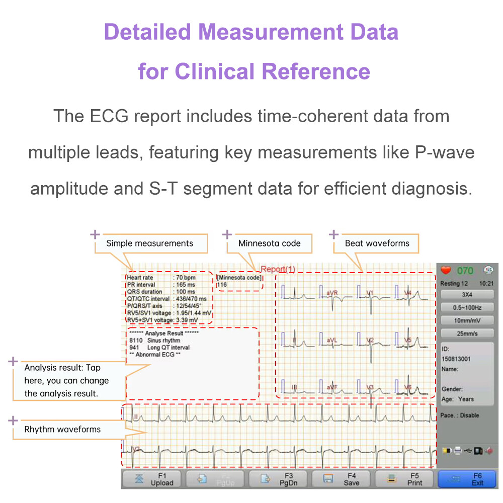 ECG Machine 12 lead/Channel with interpretation for Advisory Diagnosis Printing