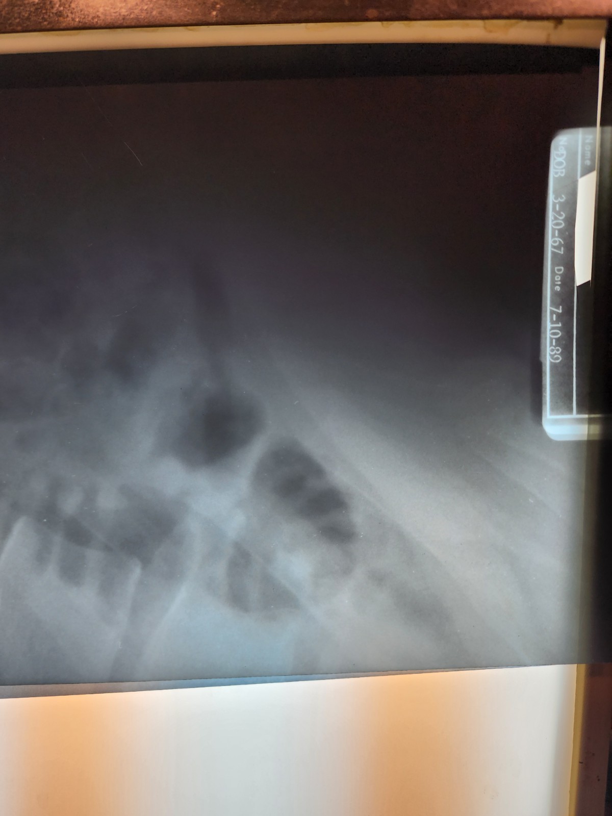 SCRAP X-RAY FILM – 1LB Silver Recovery Educational, Halloween