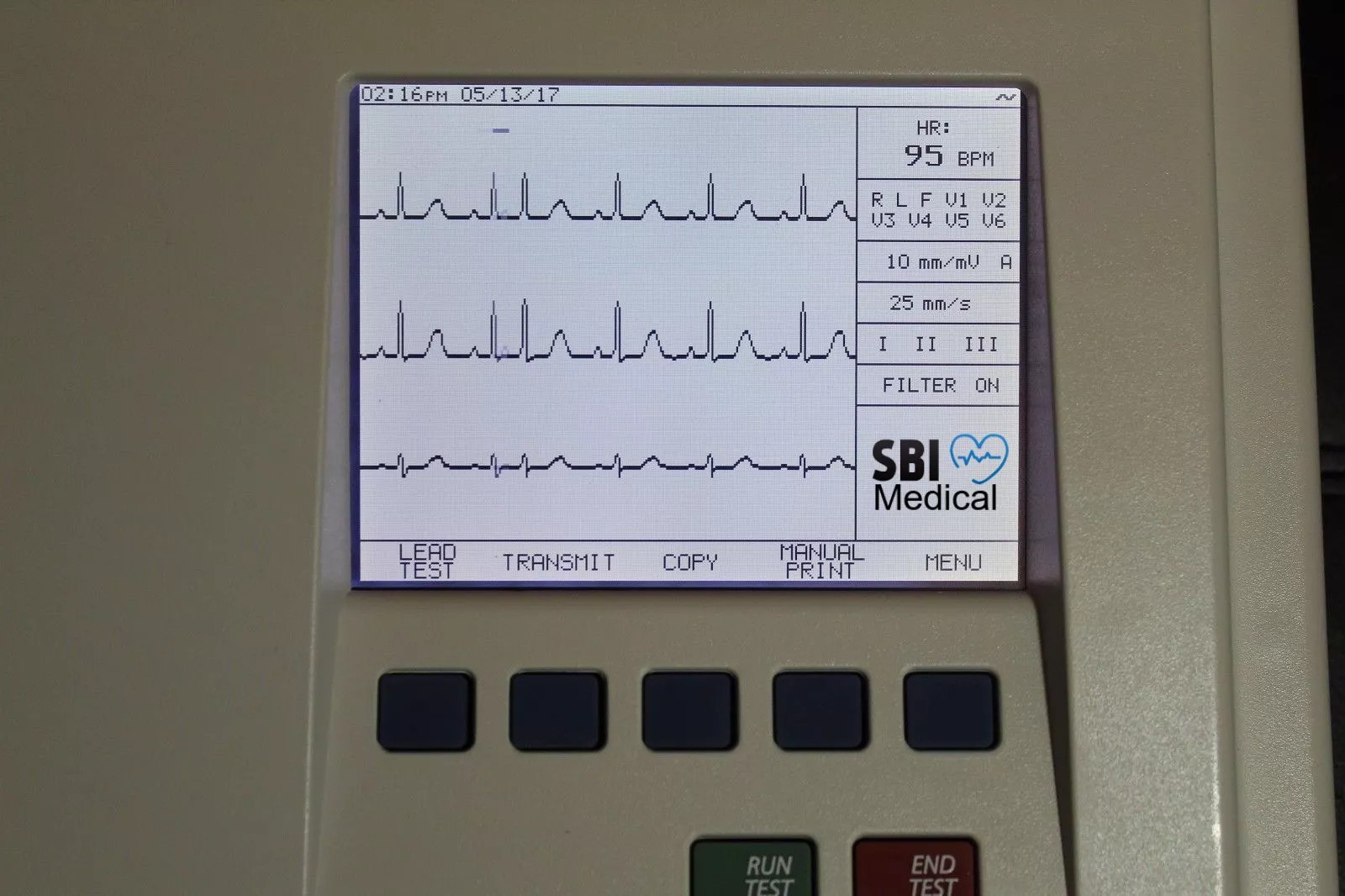 Schiller AT-102 EKG 12-Leads Resting EKG ECG machine – 2 Year Warranty –