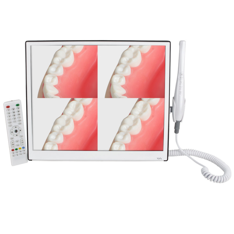 Dental Intraoral Camera CMOS1/4 Embedded Operating System&Integrated Monitor