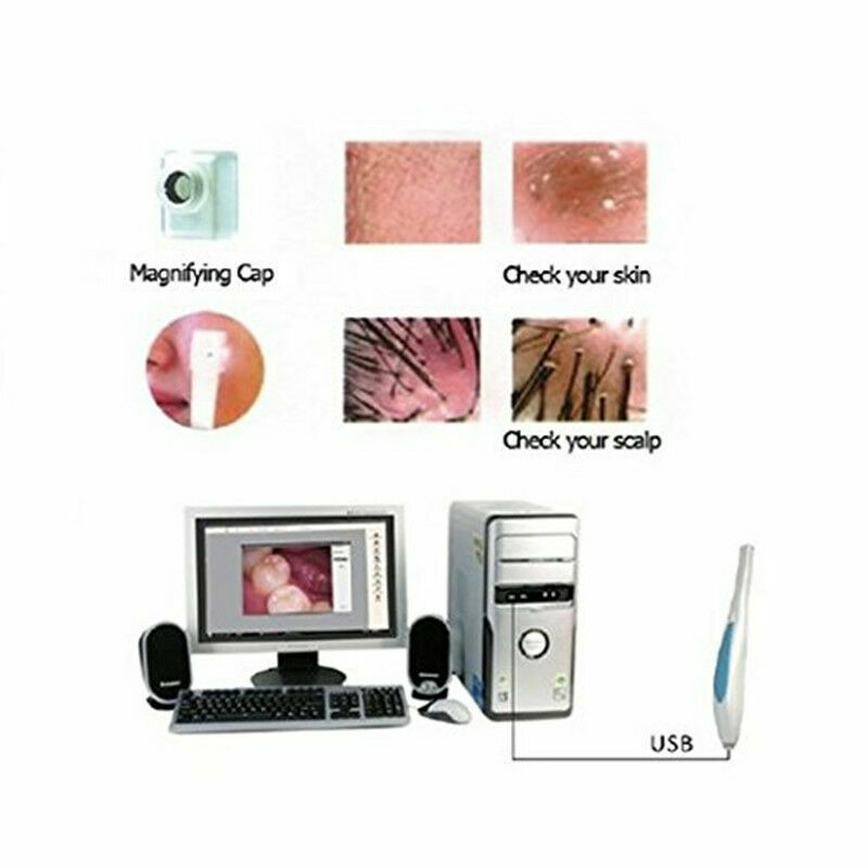MD770 Home Use USB Mini Dental Intraoral Camera 1/4″CMOS 6Pcs LED US STOCK