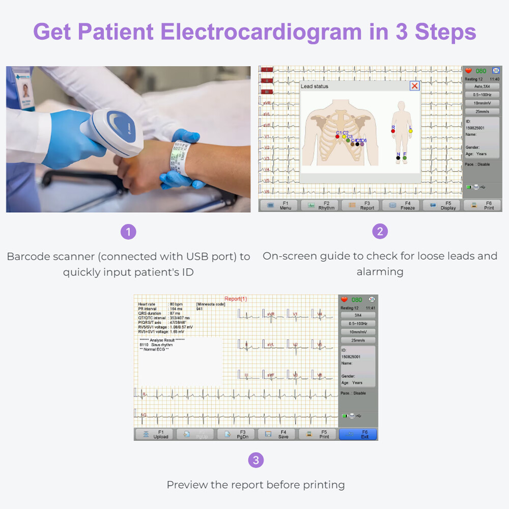 ECG Machine 12 lead/Channel with interpretation for Advisory Diagnosis Printing