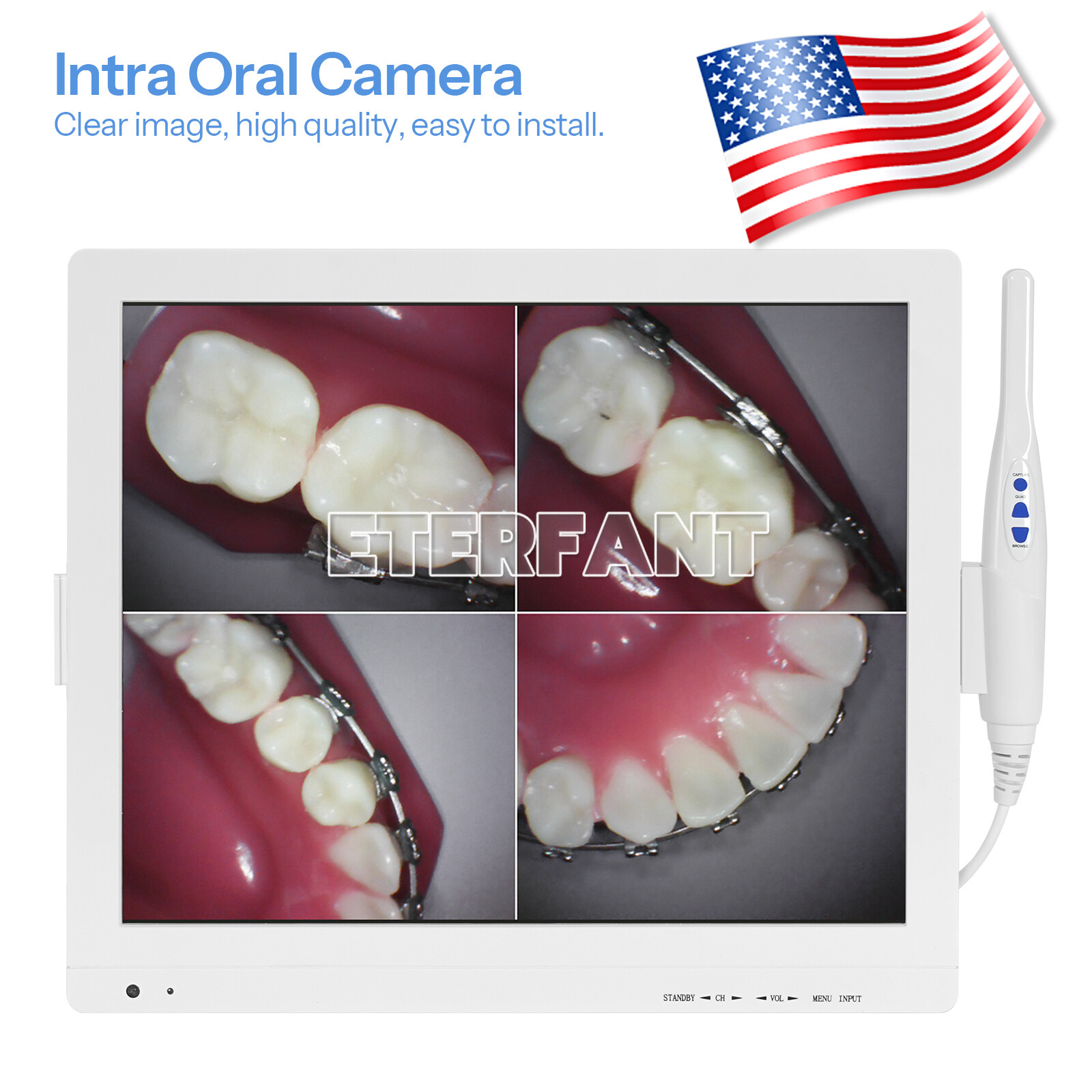 Dental Intra Oral Camera 17inch LCD Screen + 6PCs LED High-definition Macro Lens