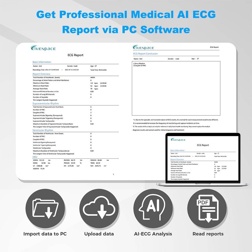 24 hours ECG/EKG Holter Monitor System with AI analysis Detects Afib PC Software