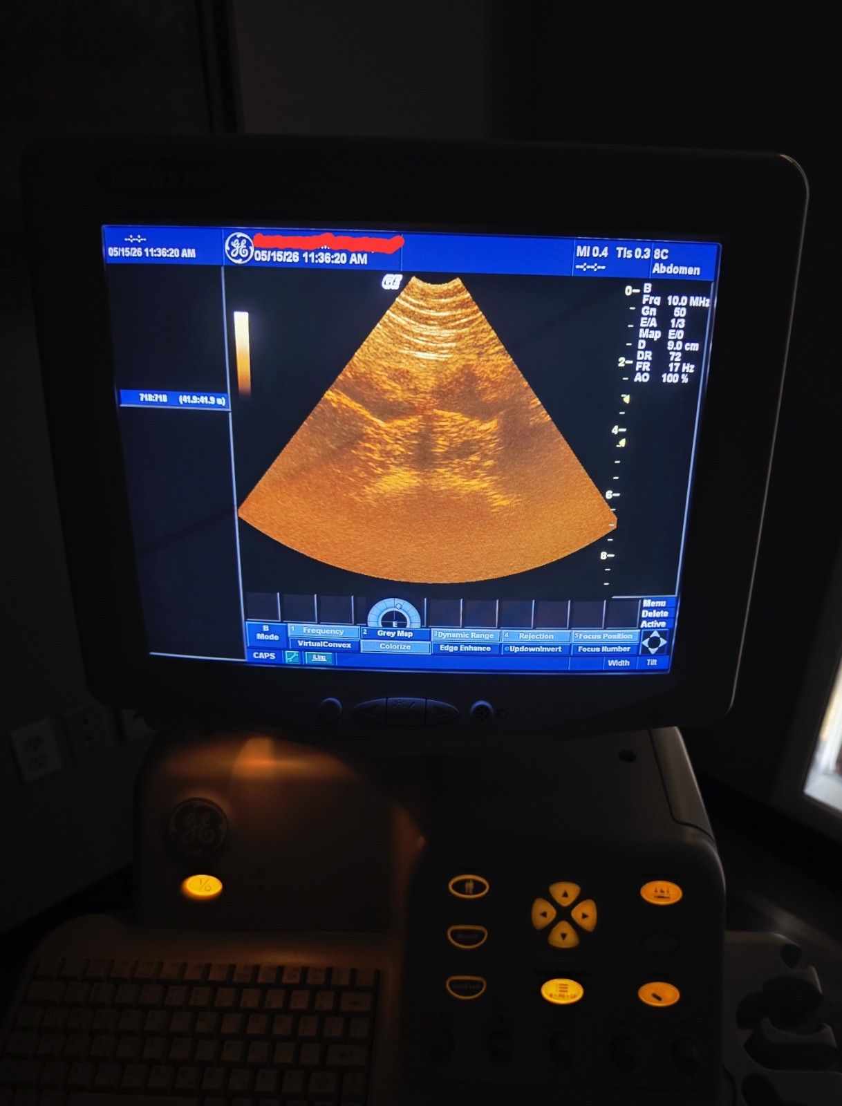 GE Logiq 5 Pro with Probe and Printer Ultrasound System Tested Working