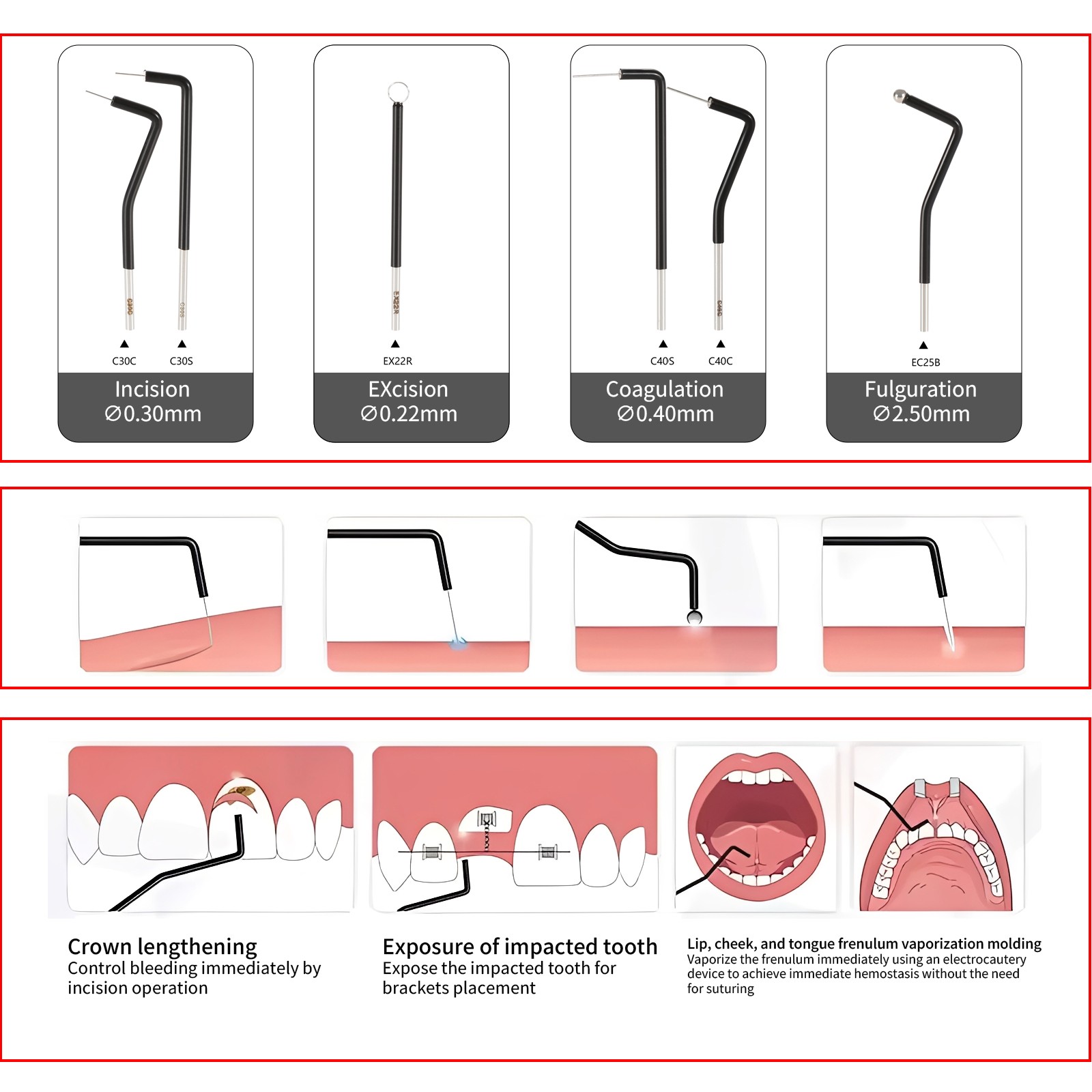 7PCS Dental Electrodes Reusable Tips Stainless Steel for Electrosurgery Unit