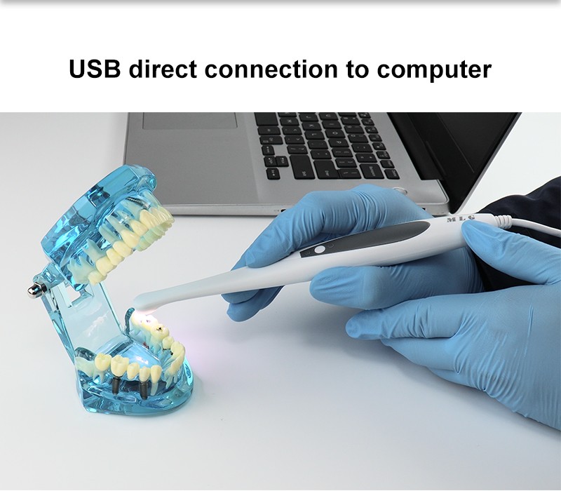 Dental Intraoral Camera USB Digital Imaging Intra Oral HD Camera 13.0 Mega Pixel