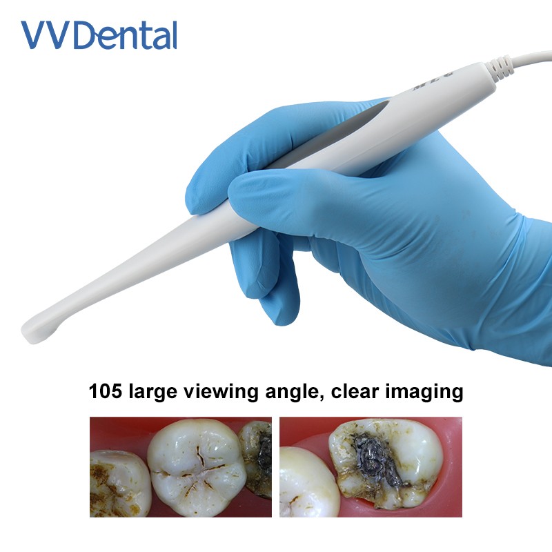 Dental Intraoral Camera USB Digital Imaging HD Camera 13.0 Mega Pixels Endoscope