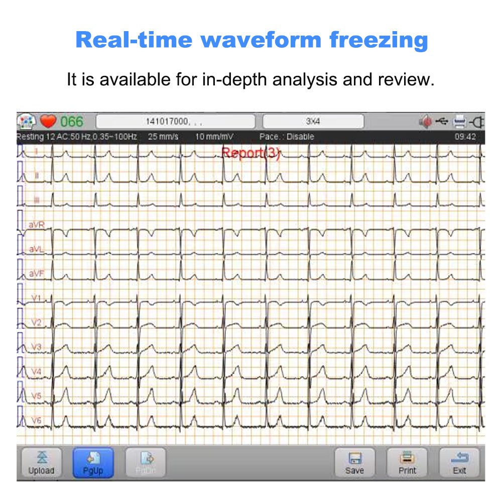 IE6 12-Lead 6-Channel ECG EKG Machine Electrocardiograph with Interpretations US